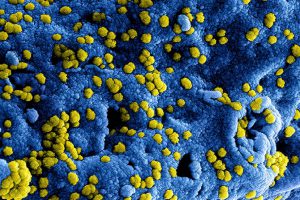 Triqs en het coronavirus
