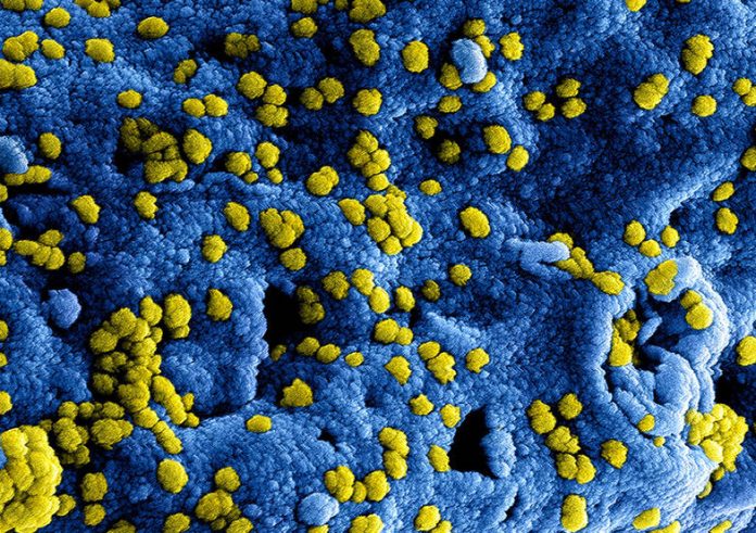Triqs en het coronavirus